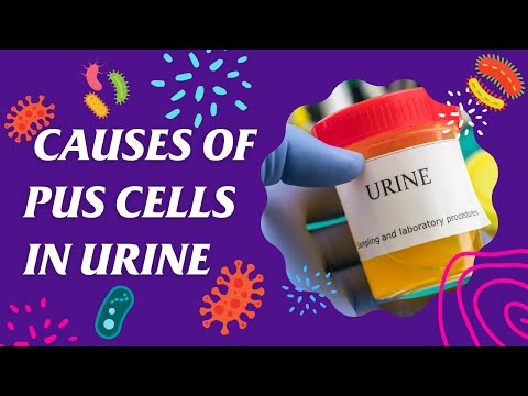 6 Main Causes of Pus Cells in Urine | Urinary tract infection | Pyuria