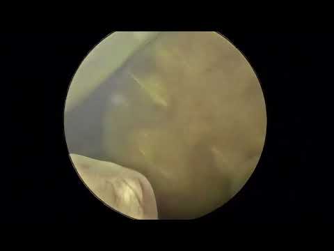 Desarrollo fetal #baby