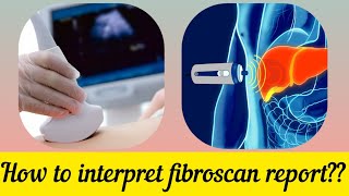 What is FibroScan? Fibroscan की रिपोर्ट को कैसे समझें @DrAshishSachan screenshot 1