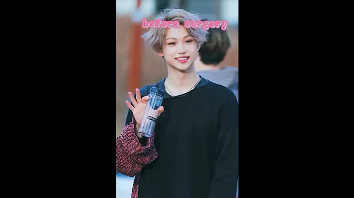 before surgery# stray kids#Felix