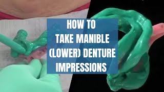 How to take mandible (lower) denture Impressions