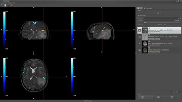 BrainMagix fMRI Module