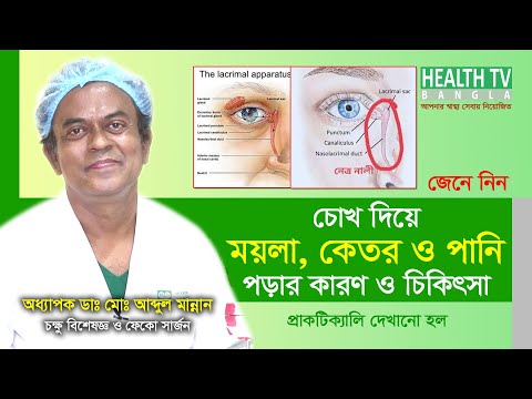 চোখ দিয়ে ময়লা, কেতর ও পানি পড়ার কারণ এবং প্রতিকার | Prof. Dr. Abdul Mannan-Eye Specialist