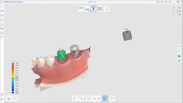 AI Scan Body Matching (ENG)