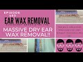 MASSIVE DRY EAR WAX REMOVAL - EP450