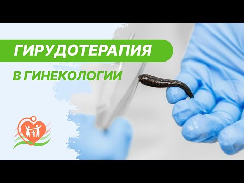 👩‍⚕️  Гирудотерапия в гинекологии. Пиявки