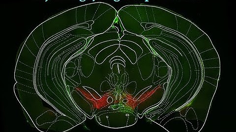 BigWarp - Overlay Brain Atlas Image on Brain Slice Image - Fiji/ImageJ
