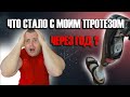 ЧТО СТАЛО С МОИМ ПРОТЕЗОМ ЧЕРЕЗ ГОД? |4 ГОДА БЕЗ НОГИ🔥