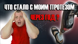 ЧТО СТАЛО С МОИМ ПРОТЕЗОМ ЧЕРЕЗ ГОД? |4 ГОДА БЕЗ НОГИ🔥