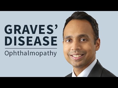 Video: Mata Penyakit Graves (Ophthalmopathy Graves): Punca Dan Rawatan