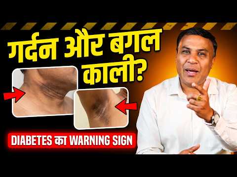 Dark Neck and Underarms? Stop Using Creams, This Is the First Warning Sign of Diabetes | Dr. Nish...