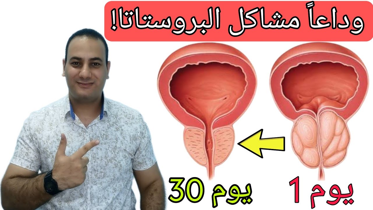 وداعا مشاكل البروستاتا لتناول اهم عنصر | علاج تنقيط وتقطير البول | وداعا ضعف الانتصاب وسرعه القذف 😍