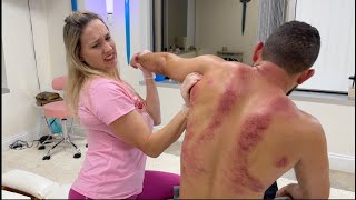 *Back Cracks* Cleaning the Stiffness Out of this MMA fighter's Back!