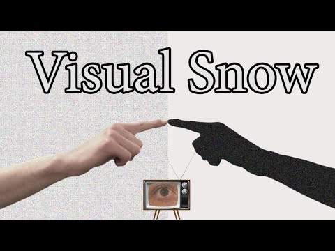 People With Visual Snow See Things Differently