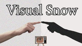 People With Visual Snow See Things Differently
