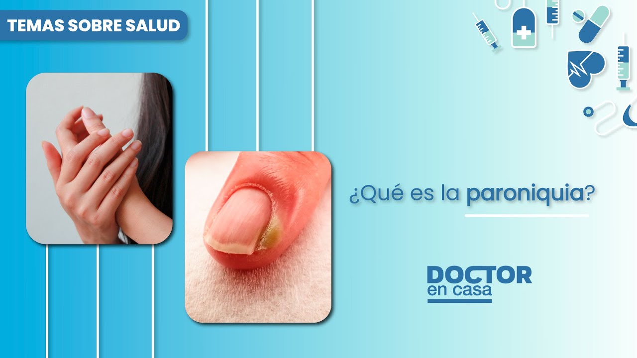 ¿Qué es la paroniquia? YouTube