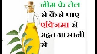 नीम के तेल से कैसे पाए एक्जिमा से राहत आसानी से | How to use NEEM Oil for Eczema