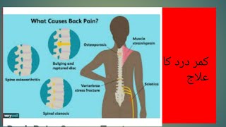 کمر درد ، اسباب اور علاج/Backache......causes and cure