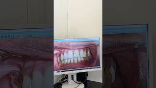 Magic#dentistswiss#dental#dentist#oralhygiene#oralcare