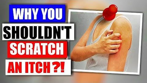 Why Scratching An Itch Makes It Worse