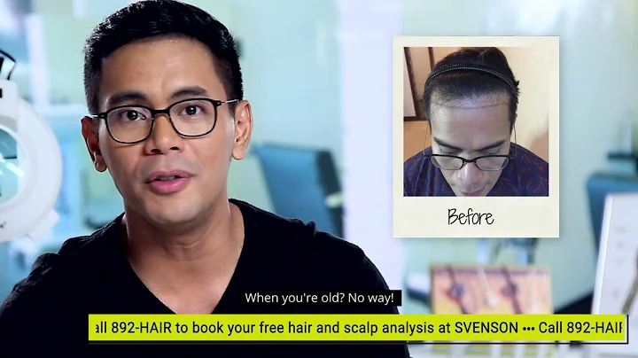 Hair Transplant at Svenson Philippines | Tonipet G...