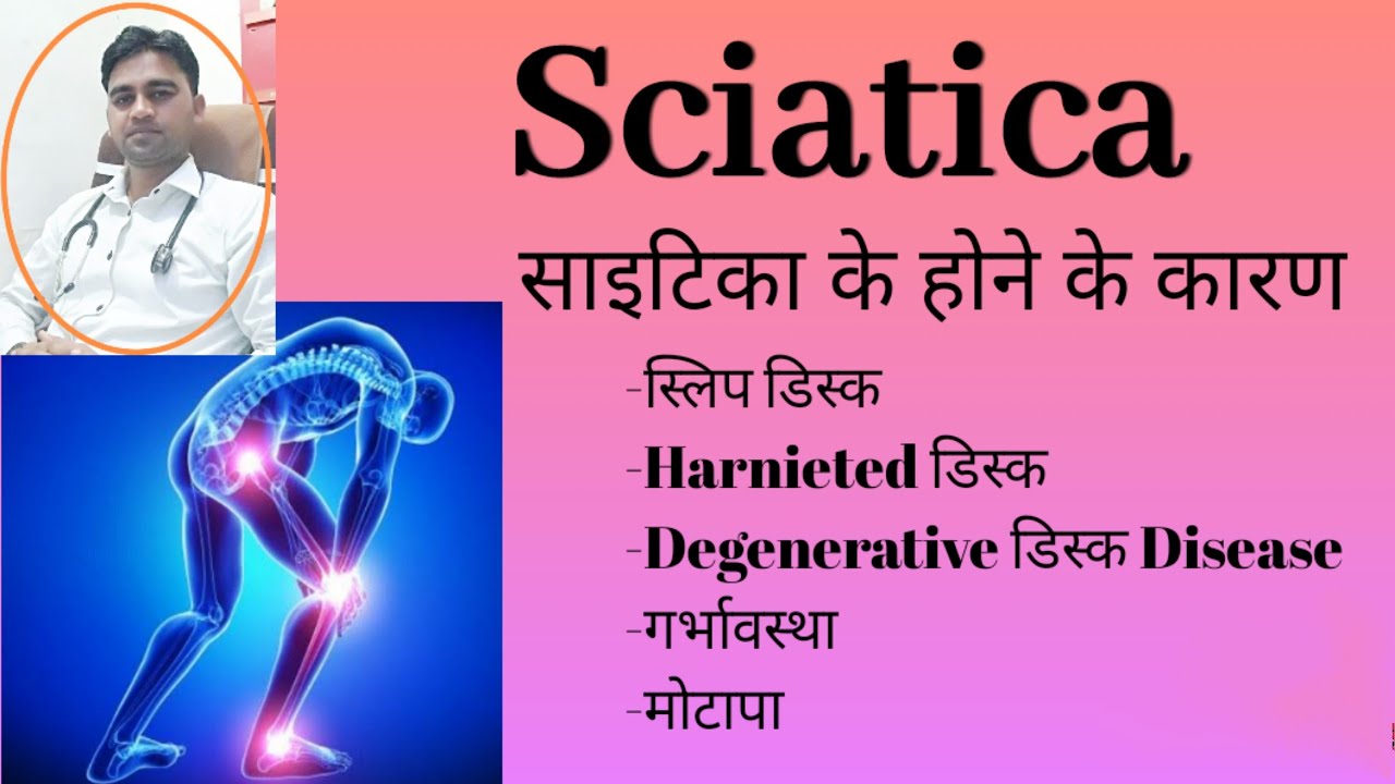 Sciatica/sciatica pain relief/sciatica exercise/sciatica treatment/slip disc/कमर दर्द /in hindi