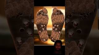 Man Foot ASMR Animation part 1#satisfying #removal#asmr #animation #dogticksremoval #shorts #viral