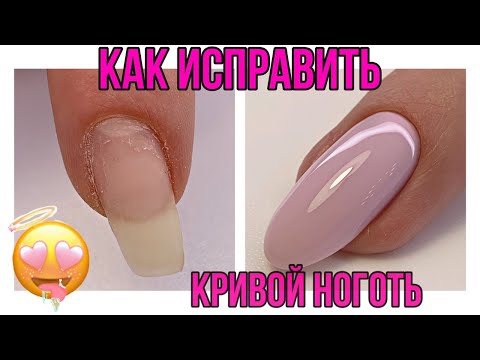 Лайфхак😍Как исправить кривой ноготь💅в сторону растущий ноготь💅Дизайн ногтей для новичков