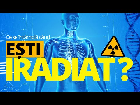 Ce se intampla cand esti EXPUS la RADIAȚII