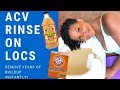 ACV RINSE ON LOCS😱😍| FIRST TIME RESULTS | HIGHLY RECOMMEND!!!