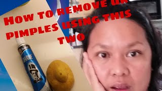 #Lemon#Colgate#How To Remove Your Pimples Using This Two LEMON AND COLGATE