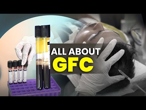GFC Explained: Is It Better Than PRP? 🧐 | What is GFC? | Hair Transplant in India | New Roots