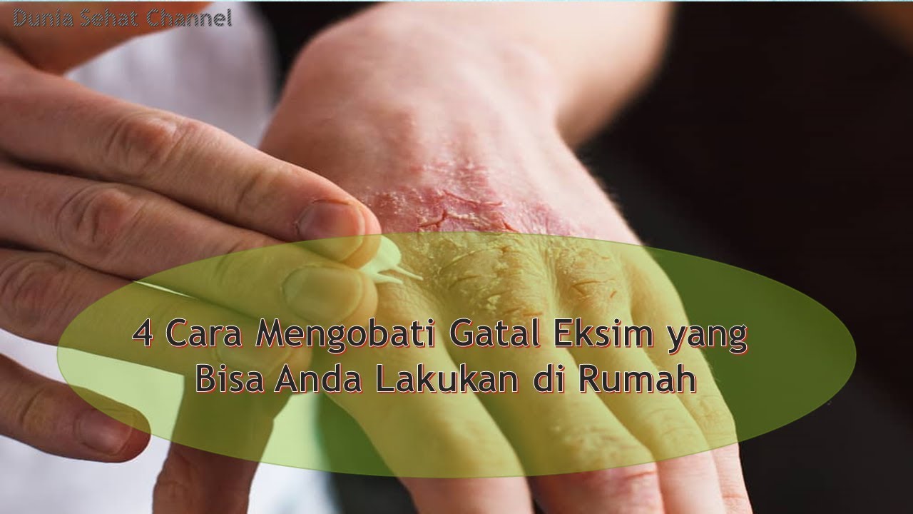 4 Cara Mengobati Gatal Eksim yang Bisa Anda Lakukan di Rumah 