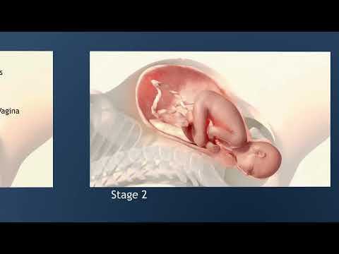 The 3 Stages Of Labor