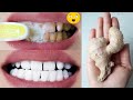 Teeth whitening in 1 minute! How to whiten your yellow teeth naturally