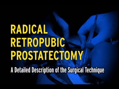 radical retropubic prostatectomy