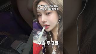 눈코윤곽 한번에 수술한 결과 #shorts