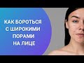 КАК БОРОТЬСЯ С ШИРОКИМИ ПОРАМИ НА ЛИЦЕ