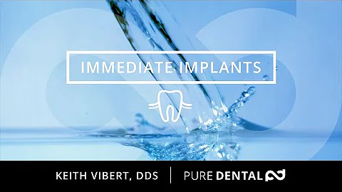 Immediate Dental Implants / Pure Dental / Dr. Vibert