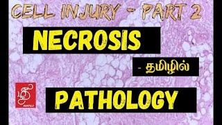 NECROSIS - IN TAMIL (GENERAL PATHOLOGY)