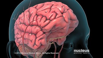 Ischemic Stroke Animation - Cook Children