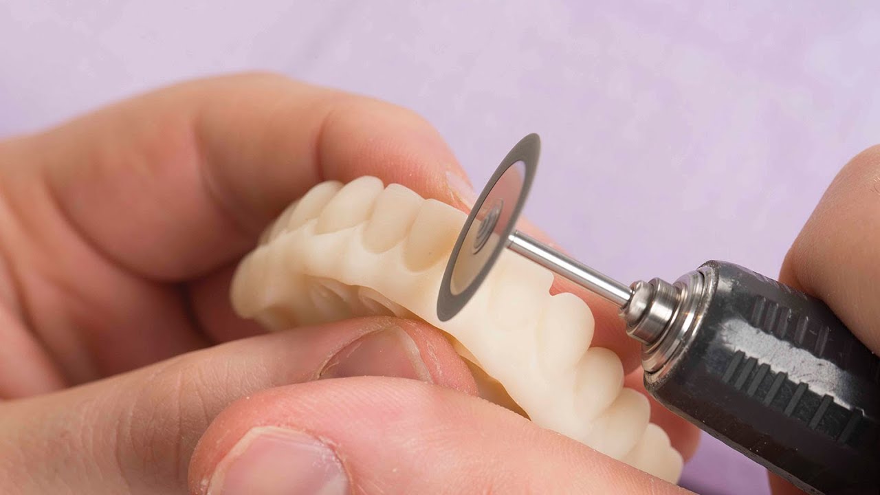 Lab Sense Provisional CAD/CAM FullArch Implant Prosthesis (Vol. 5