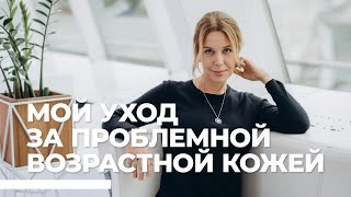 Уход за проблемной возрастной кожей. Мой опыт || Simple living