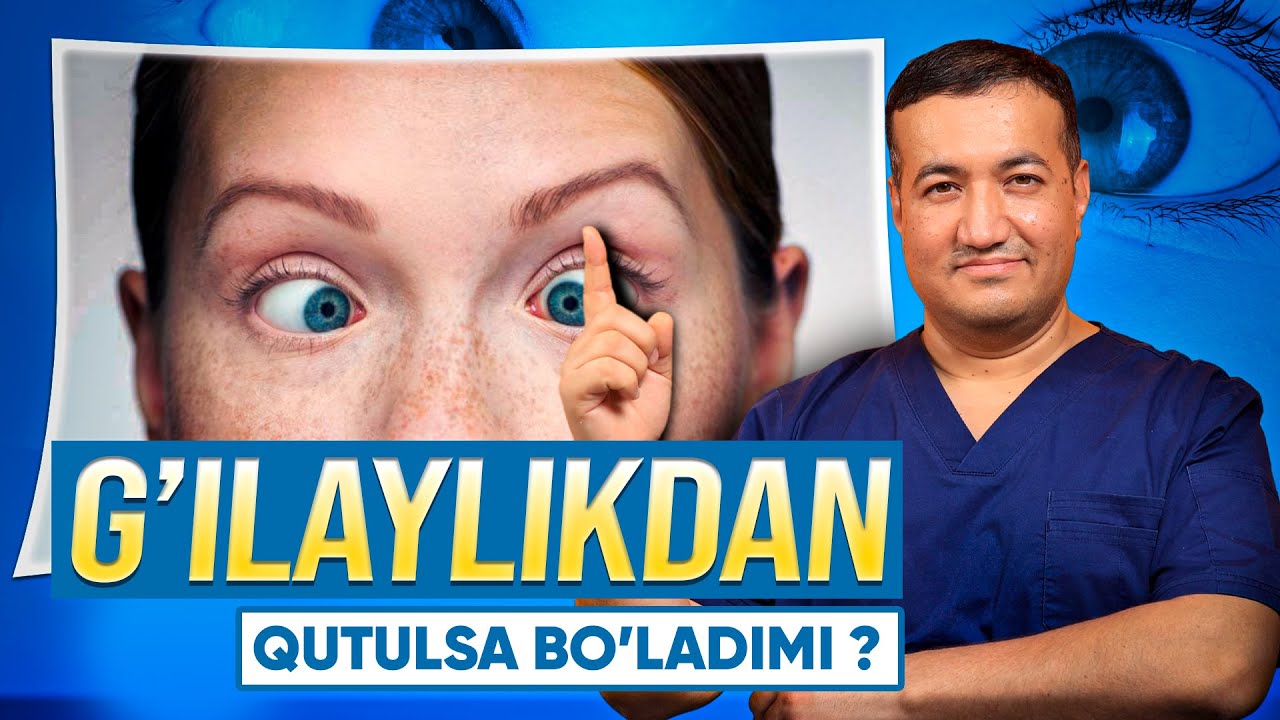 G'ilaylikni 100% davolasa bo'ladimi ? | Ko'z Nuri klinikasi