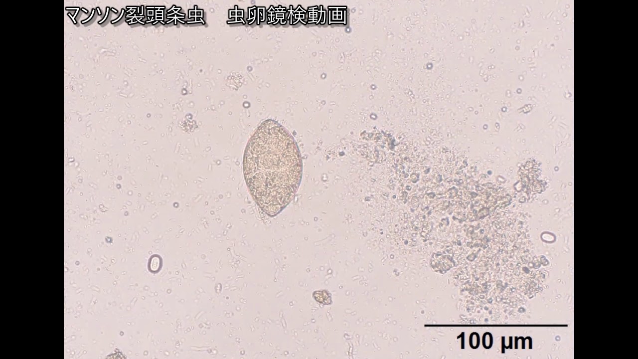 寄生虫 臨床検査 マンソン裂頭条虫 虫卵 鏡検動画 Youtube