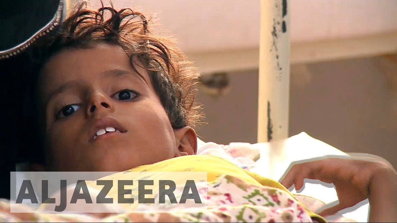 انتشر وباء الكوليرا في اليمن إلى 21 منطقة