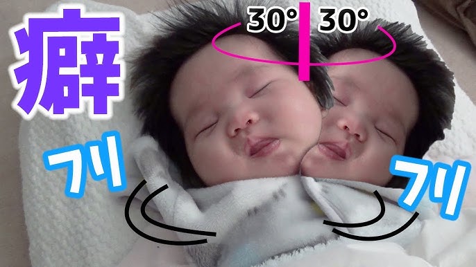 眠い時に激しく首 頭 を振る赤ちゃんの癖 心配 Baby S Habit Of Shaking The Neck Head Violently When Sleepy Worry Youtube