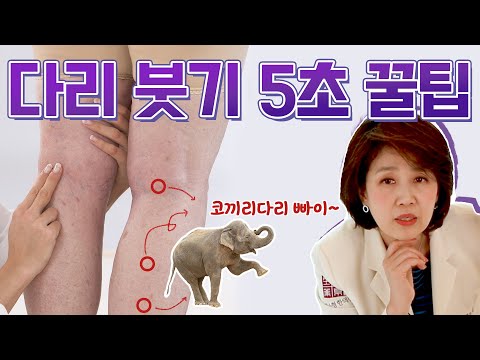 다리 붓기 없애는 5초 꿀팁! 여기만 꾹꾹 눌러주면 코끼리 다리 빠이빠이~