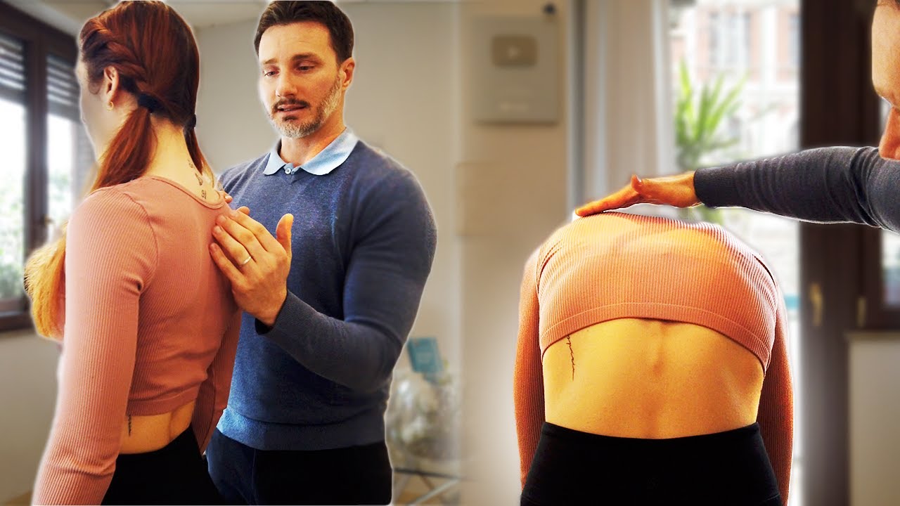 I Couldn't Believe the Transformation! Before & After a Scoliosis Treatment