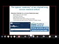 Understanding a Lung Cancer Research Study Webinar